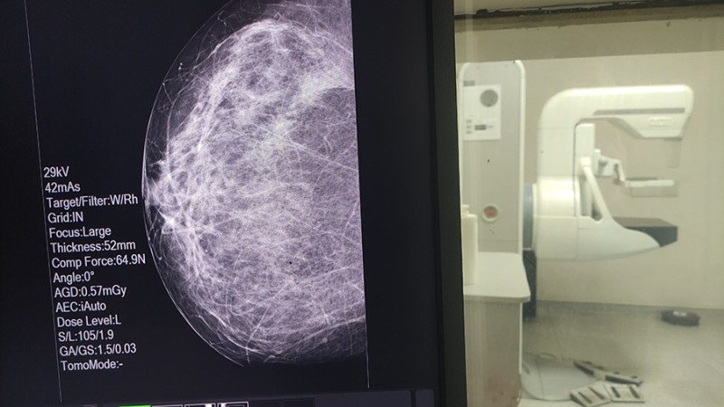Doktor kanserde erken teşhise kendinden örnek verdi