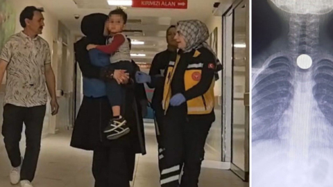 Bursa’da çocuğun yuttuğu madeni para yemek borusuna takıldı!