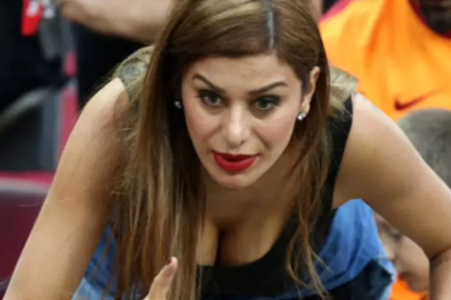 Botoks yaptıran Ebru Şancı'nın tek kaşı havada kaldı