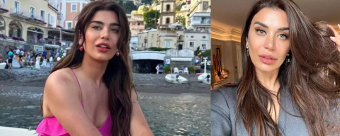 Botoks yaptıran Ebru Şancı'nın tek kaşı havada kaldı