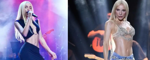 Gülşen’in yüzündeki değişim sosyal medyada gündem oldu