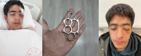 15 yaşındaki çocuk akranları tarafından muştayla öldüresiye dövüldü