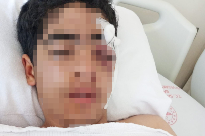 15 yaşındaki çocuk akranları tarafından muştayla öldüresiye dövüldü